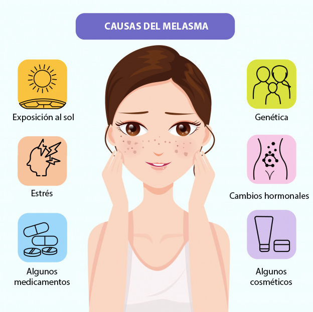 Causas del melasma